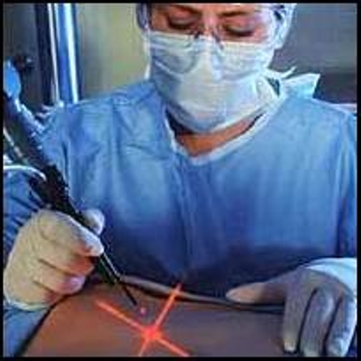 Лазерное лечение в гинекологии